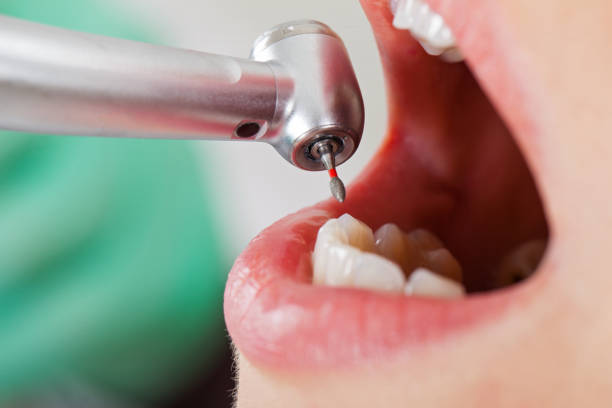 Best Weekend Emergency Dentist in Seaside, OR